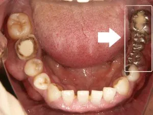 1/1.8 , Dental3