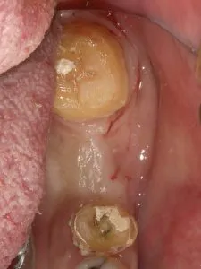 x1.2 , Dental3