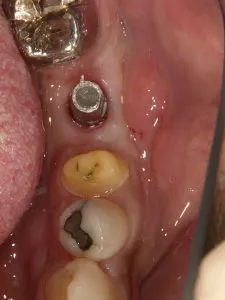 x1.1 , Dental3