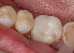 ﾄﾞｯｸ5