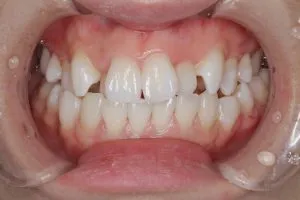 1372_5084236