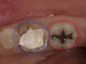 x1.2  , Dental3