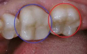 1/1.1 , Dental2