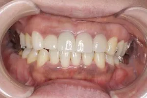 1458_6955236