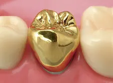ゴールドクラウン(18K)